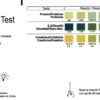 Kidney Function Test | Urine Testing Strip Kits | 5 Tests - Image 2