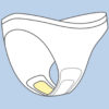 One Step: AMNIOCHECK Amniotic Leak Self-Test Detector - Image 3
