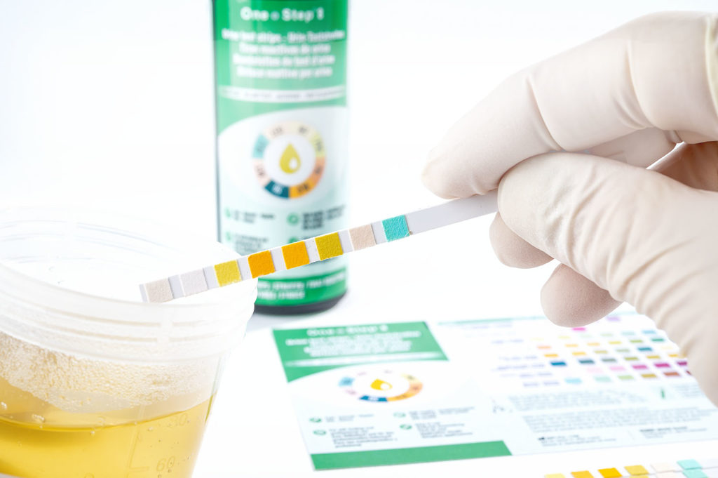 8 Parameter Urine Test Strips 1 X 100 Dipstick Tests Ketone Glucose Ph Home Health Uk 7184