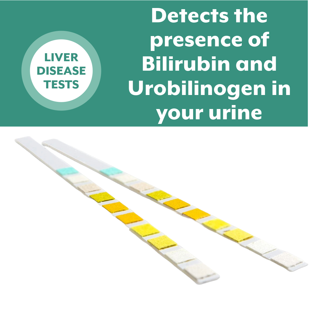 Liver Function Test, Cirrhosis Bilirubin Urine Strip