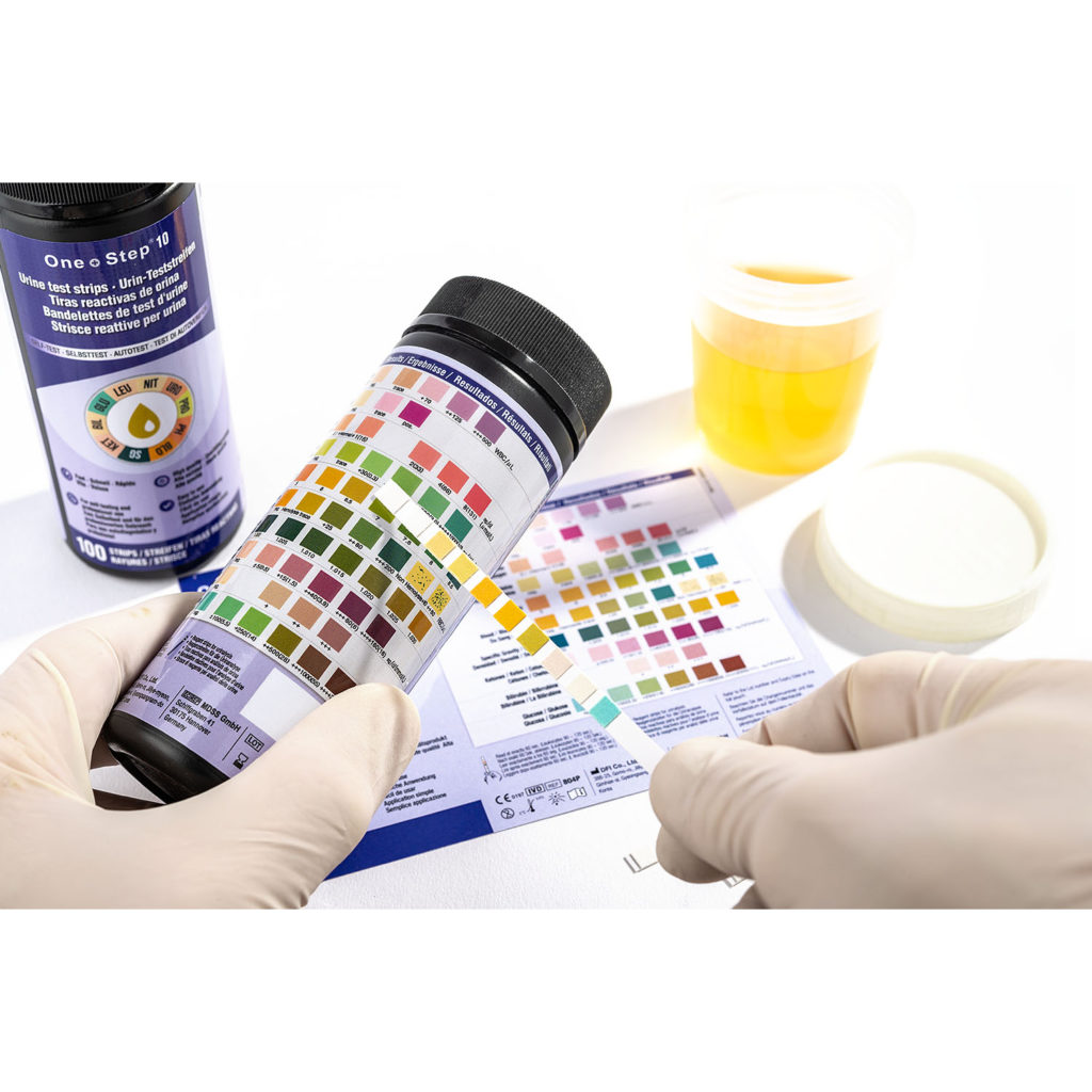 10 Parameter Urine Strips Dipstick Tests 100 Test Strips Home Health Uk 6297
