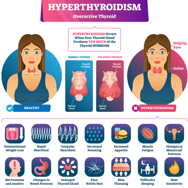 Hyperthyroidism test kit