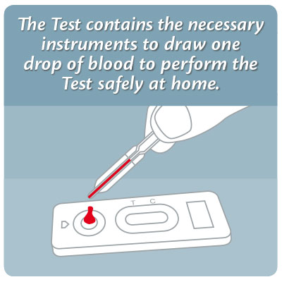 What is a high IgE blood level?