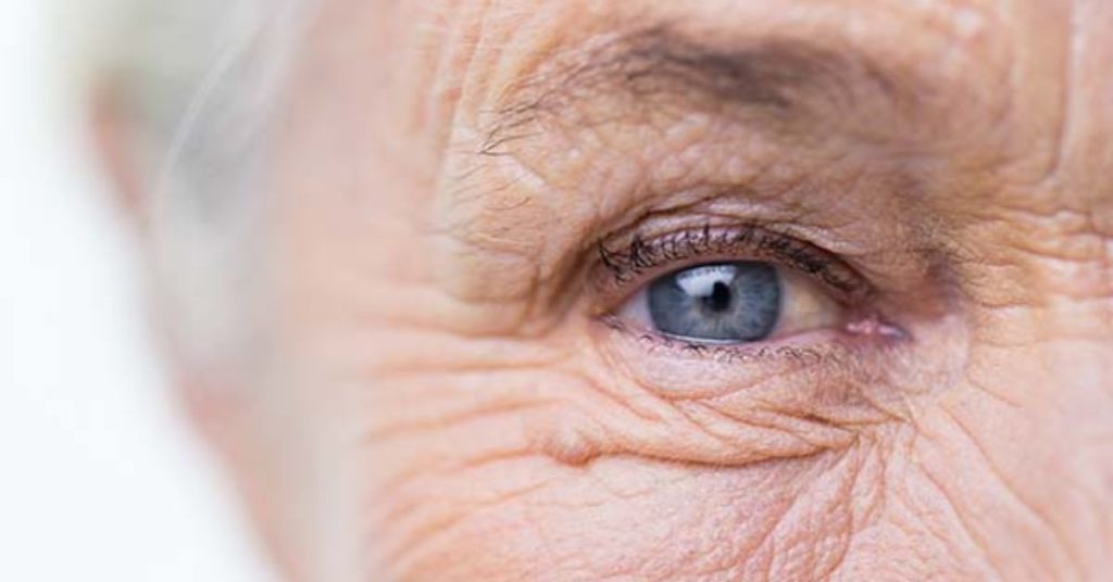 elderly lady's eye