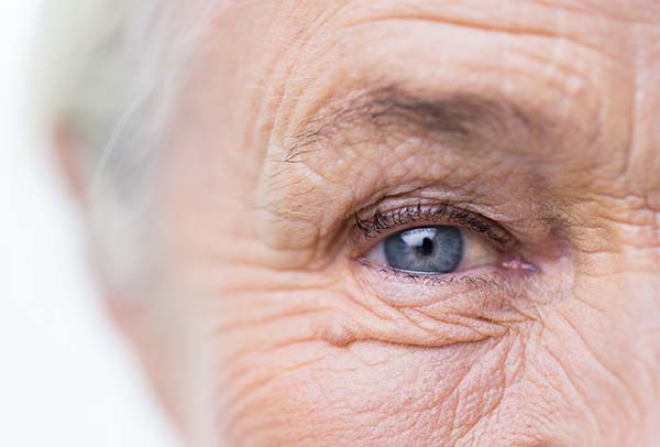 elderly persons eye